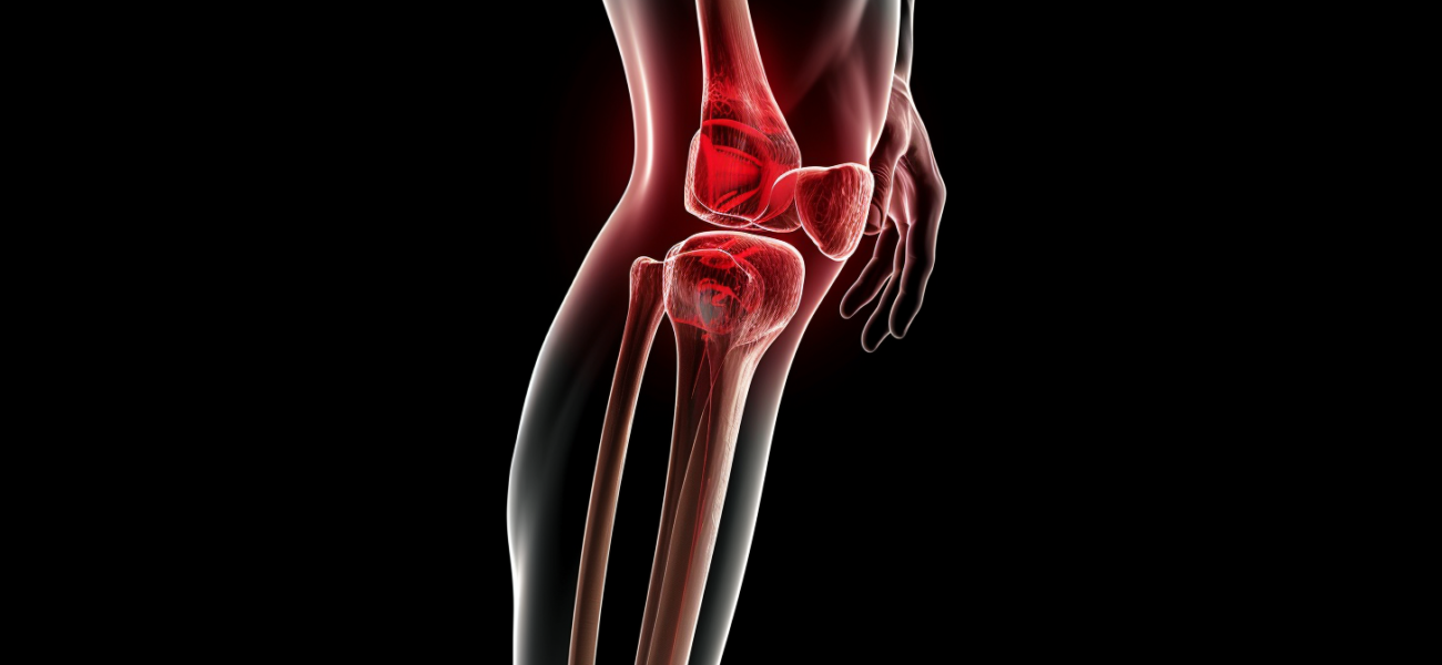Understanding Knee Arthritis