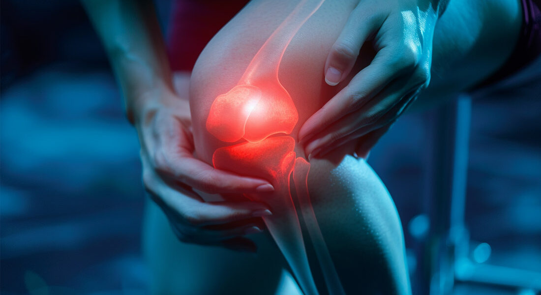 Can Plantar Fasciitis Cause Knee Pain?